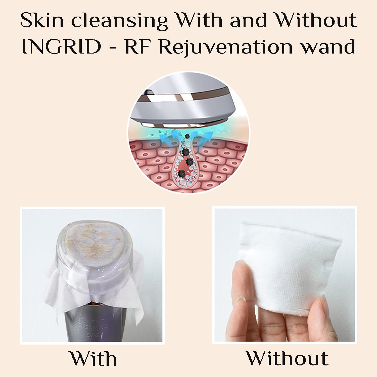 ENDOWAND - RF, Hot and Cold Skin rejuvenation